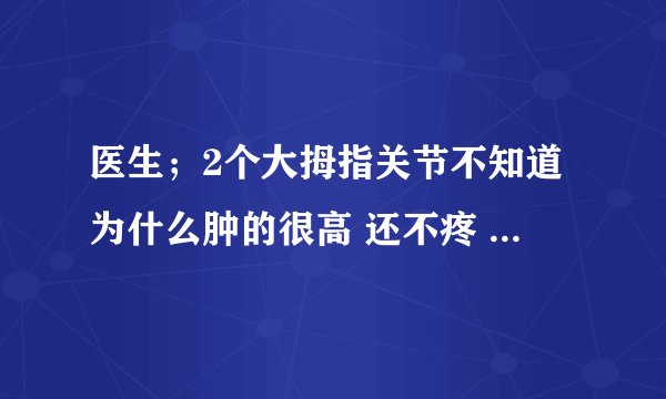 医生；2个大拇指关节不知道为什么肿的很高 还不疼 这是...