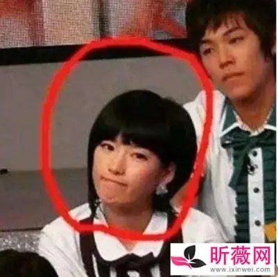 潘南奎以前的样子：潘南奎整容后的美照欣赏