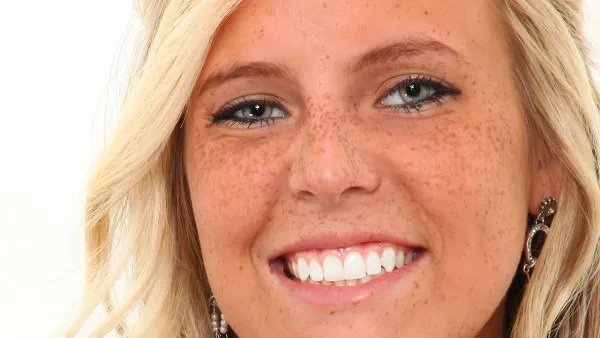 怎样祛除黄褐斑