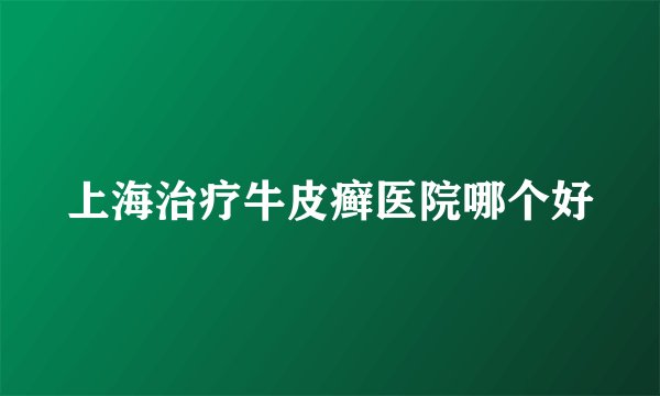 上海治疗牛皮癣医院哪个好