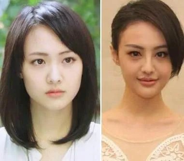 你们觉得郑爽整容前漂亮还是整容后漂亮？
