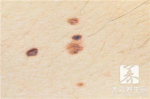  身上长痣面相图解大全