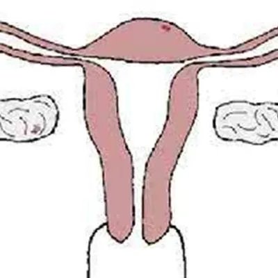 盆腔疾病有哪些?