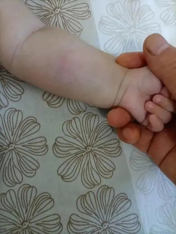 愤怒！天降烟灰杯砸中3月大女婴 排查200户无人承认