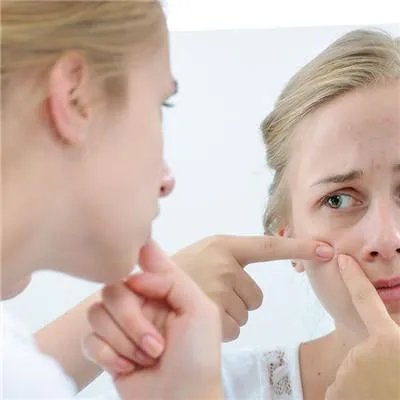 治疗青春痘哪家医院最好