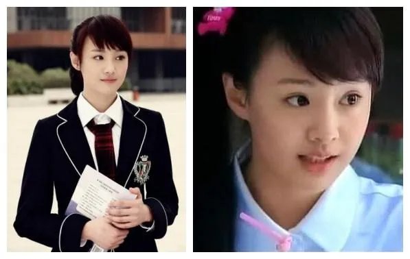 你们觉得郑爽整容前漂亮还是整容后漂亮？