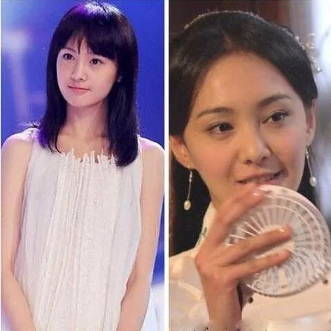 你们觉得郑爽整容前漂亮还是整容后漂亮？