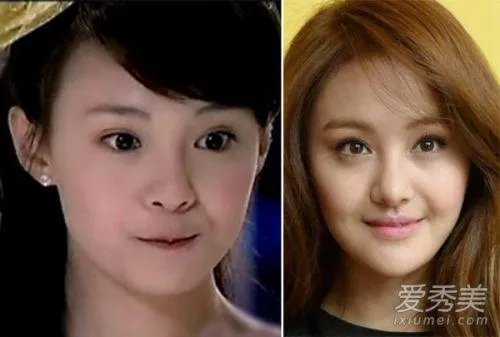 你们觉得郑爽整容前漂亮还是整容后漂亮？