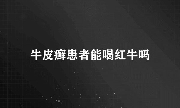 牛皮癣患者能喝红牛吗