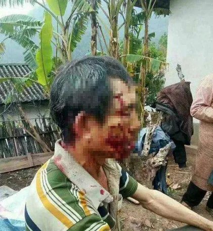 云南一老人四年两次被熊袭击是怎么回事？