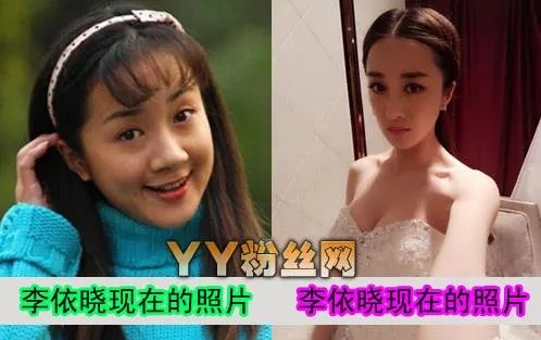 李依晓个人资料:李依晓整容前后照片对比(图)
