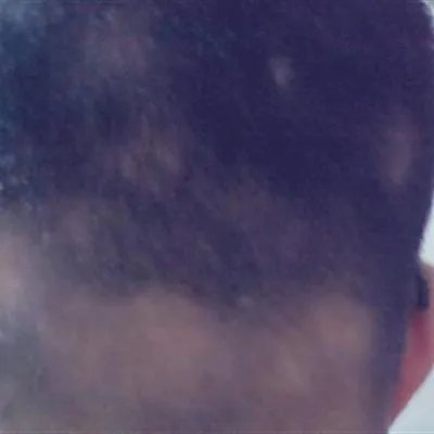 突然掉头发很厉害什么原因