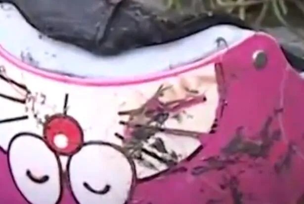 杭州电瓶车烧伤女孩或终生插管是怎么回事 杭州电瓶车烧伤女孩或终生插管具体情况