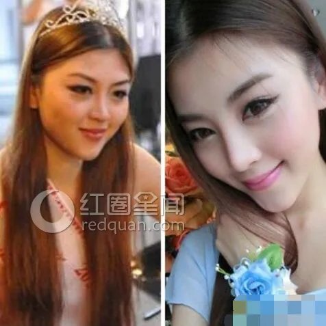 龚美琪整容前后对比照 龚美琪结婚对象是谁