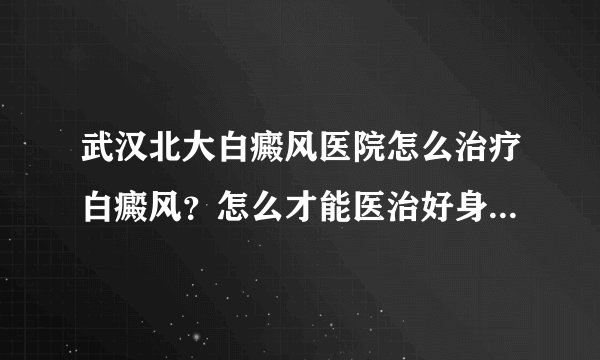 武汉北大白癜风医院怎么治疗白癜风？怎么才能医治好身上的白癜风呢?