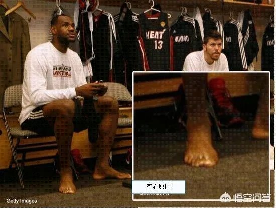 詹姆斯六个脚趾