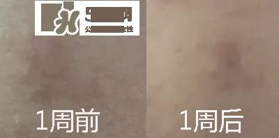 薇姿的护肤品怎么样 薇姿属于什么档次