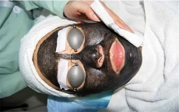 黑脸娃娃副作用有哪些