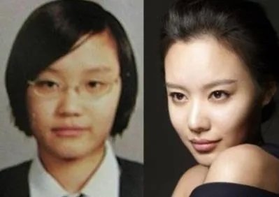 金雅中整容了吗:金雅中前后对比照