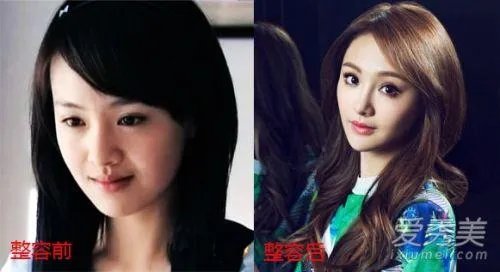 你们觉得郑爽整容前漂亮还是整容后漂亮？