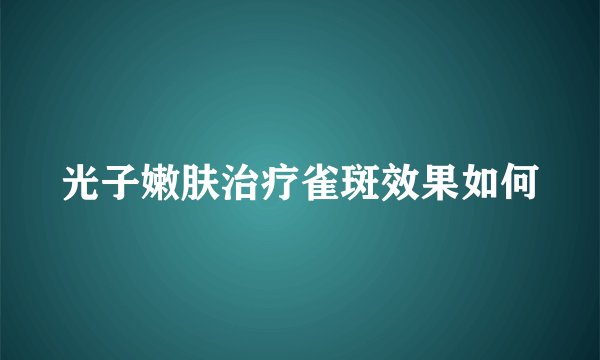 光子嫩肤治疗雀斑效果如何