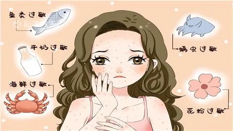 季节性皮肤过敏怎么办