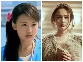 你们觉得郑爽整容前漂亮还是整容后漂亮？