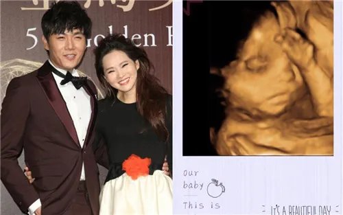 伊能静或高龄早产 辛苦怀孕只为让秦昊当上父亲