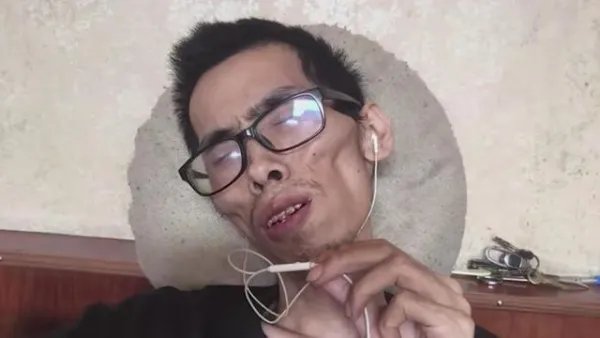 抗癌小伙阿健逝世，他到底经历了哪些坎坷？