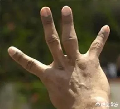 詹姆斯六个脚趾