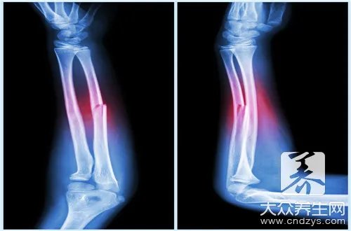  股骨头康复治疗仪