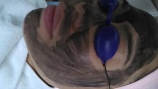 黑脸娃娃做一次要多少钱