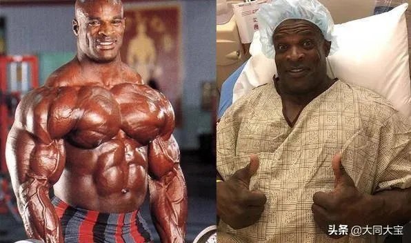 健美皇帝罗尼库尔曼最近又动手术了，难道竞技健美非得牺牲身体健康为代价嘛？