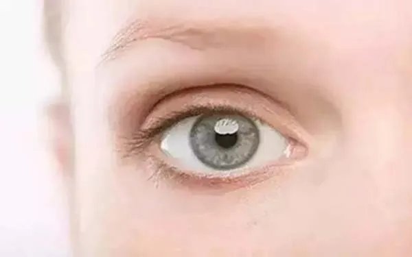 上海全切双眼皮哪几家整形医院做的好