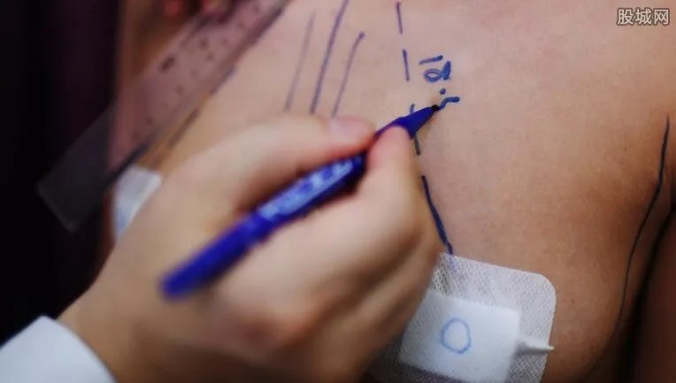 小伙花43万整容变性 男性整容的风险有多高