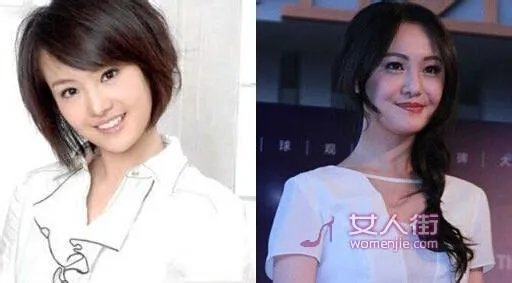 你们觉得郑爽整容前漂亮还是整容后漂亮？