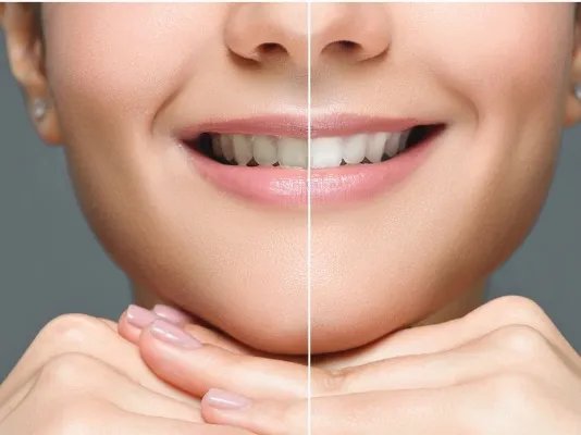 吃什么食品可以快速美白