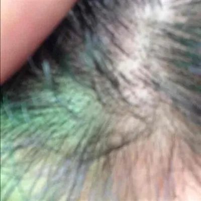 突然掉头发很厉害什么原因