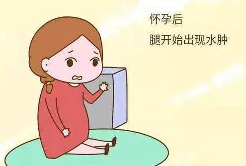 张梓琳怀孕6月状态依旧很好,孕期该有的状态应该是怎样的?