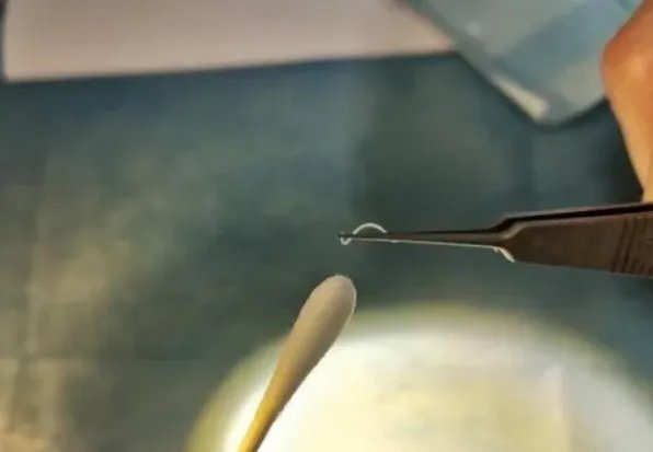 武汉一男童眼里捉出6条蠕动活虫，这些活虫究竟从何而来？