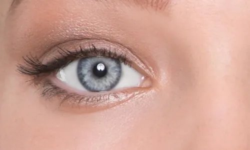 埋线重睑术会反弹吗