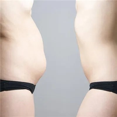 不吃药减肥方法