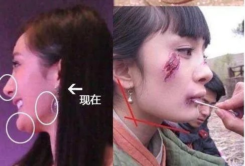 面对被质疑整容，从明星的回应就能猜出到底整没整