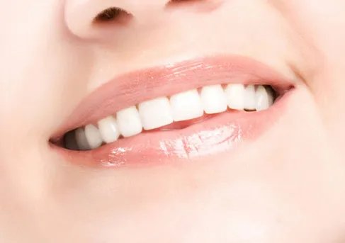 冷光牙齿美白大概多少钱