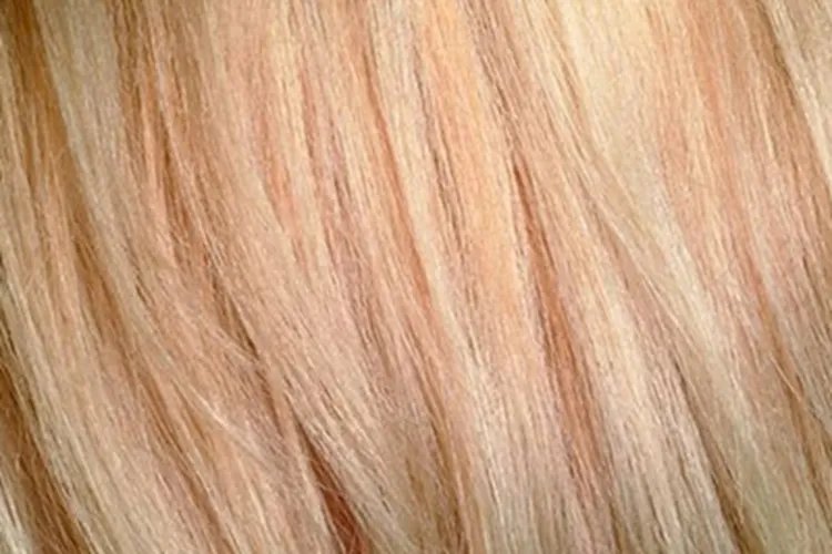 职业性毛发改变毛发变黄图片