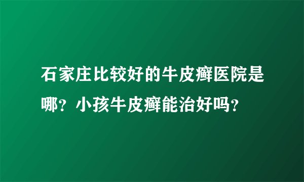 石家庄比较好的牛皮癣医院是哪？小孩牛皮癣能治好吗？