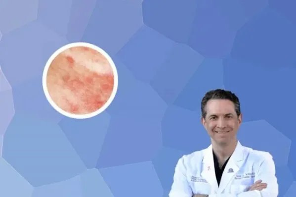 可善挺需要一直注射吗