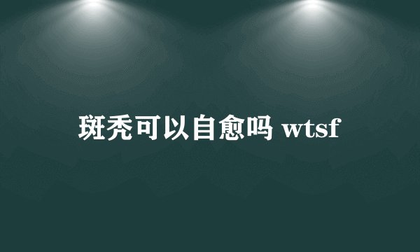 斑秃可以自愈吗 wtsf