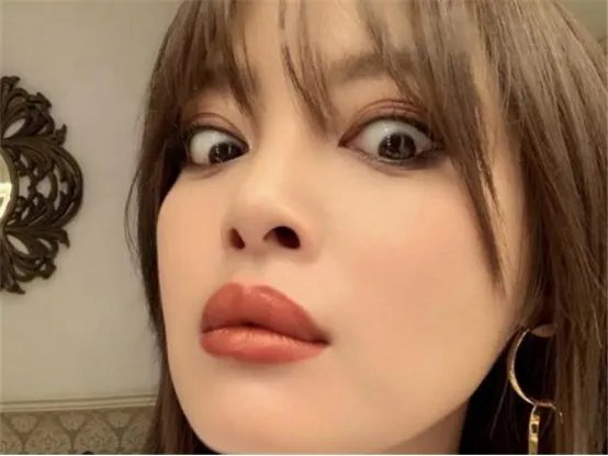 辛芷蕾奇怪的嘴巴引起广大争议，是天生的形状还是整容失败？
