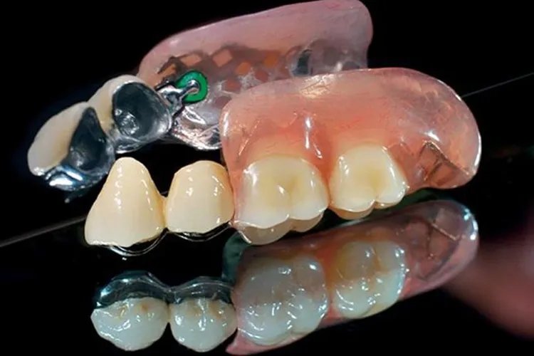 可摘局部义齿图片